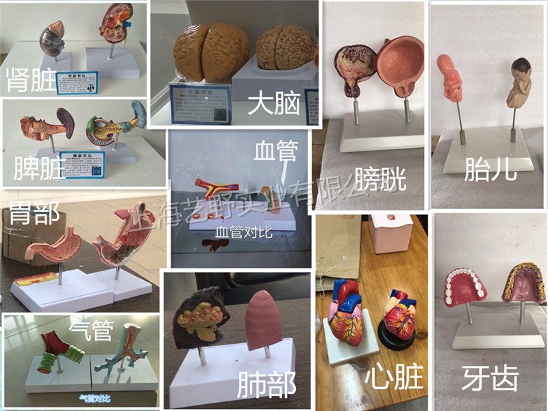 器官對(duì)比